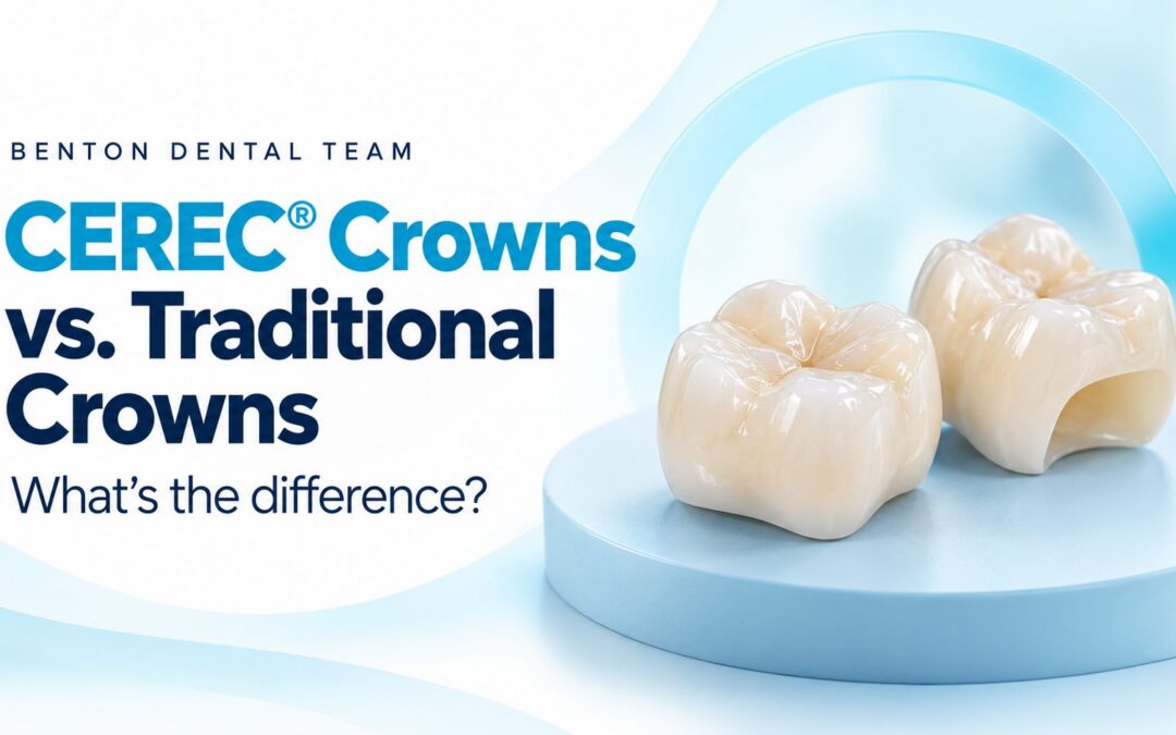 What Is a CEREC® Crown and How Is It Different from a Regular Crown?